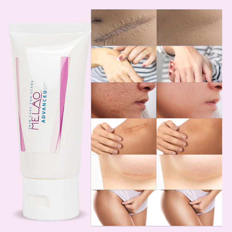 MELAO Scar Removal Gel for Stretch Marks and Acne Repair