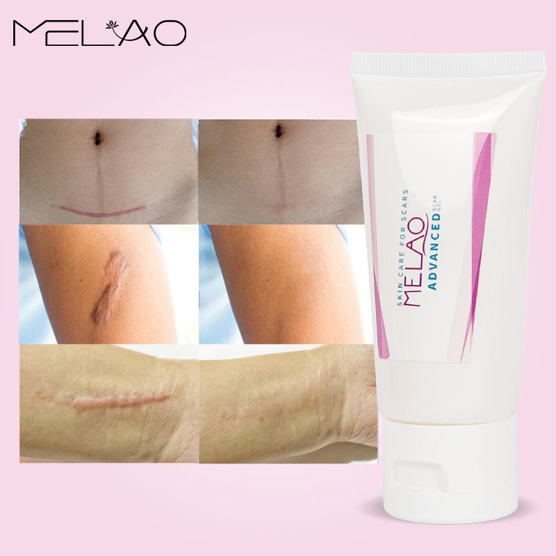 MELAO Scar Removal Gel for Stretch Marks and Acne Repair